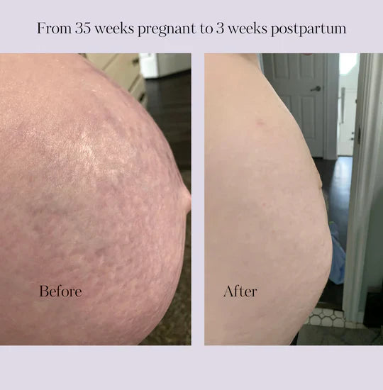 Revitalize Postpartum Cream Refill Pouch